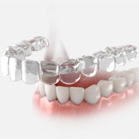 Clear Aligners in Franklin Park 