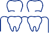 Animated dental implant supported fixed bridge