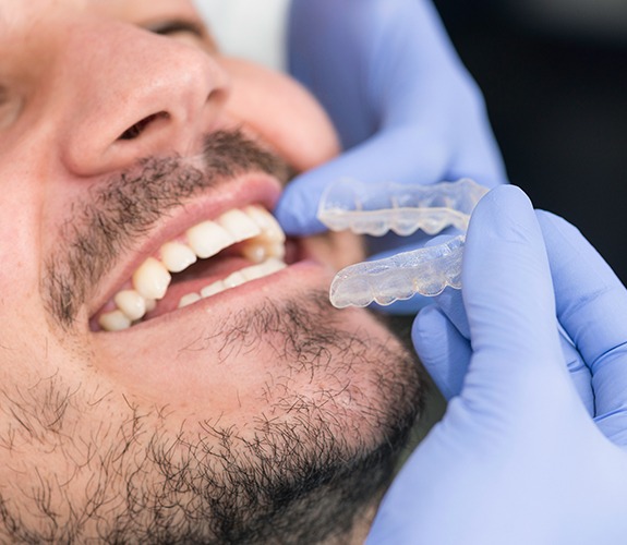 Orthodontist placing Invisalign tray