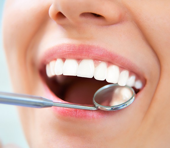 Dentist checking patient's tooth colored fillings