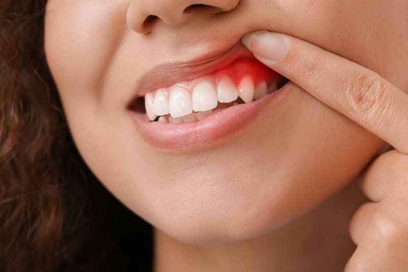 patient with red inflamed gums